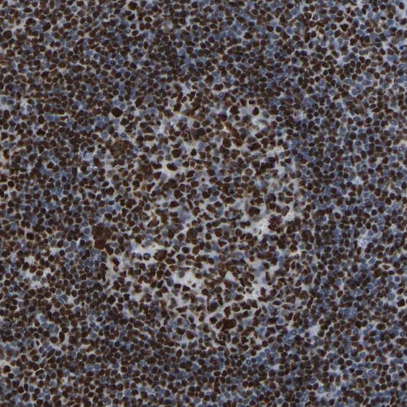 Staining of human tonsil shows strong nuclear positivity in lymphoid cells.