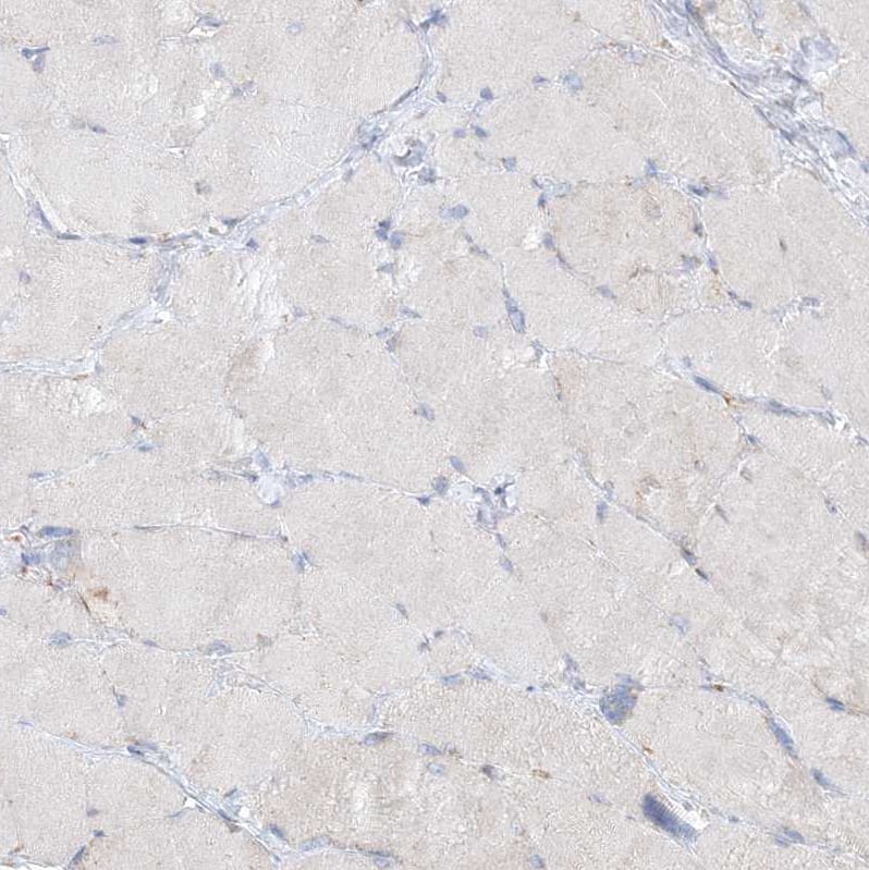 Staining of human skeletal muscle shows no positivity in myocytes as expected.