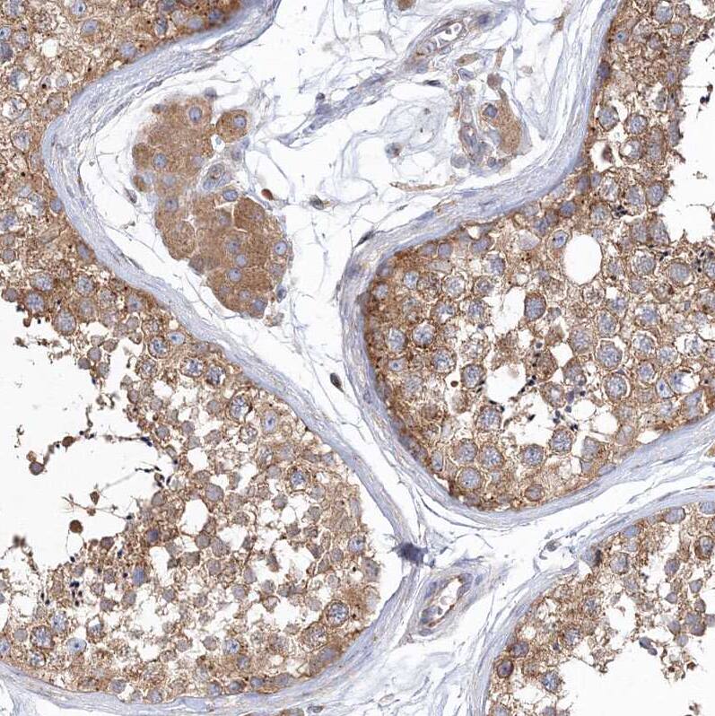 Staining of human testis shows moderate granular cytoplasmic positivity in cells in seminiferous ducts.