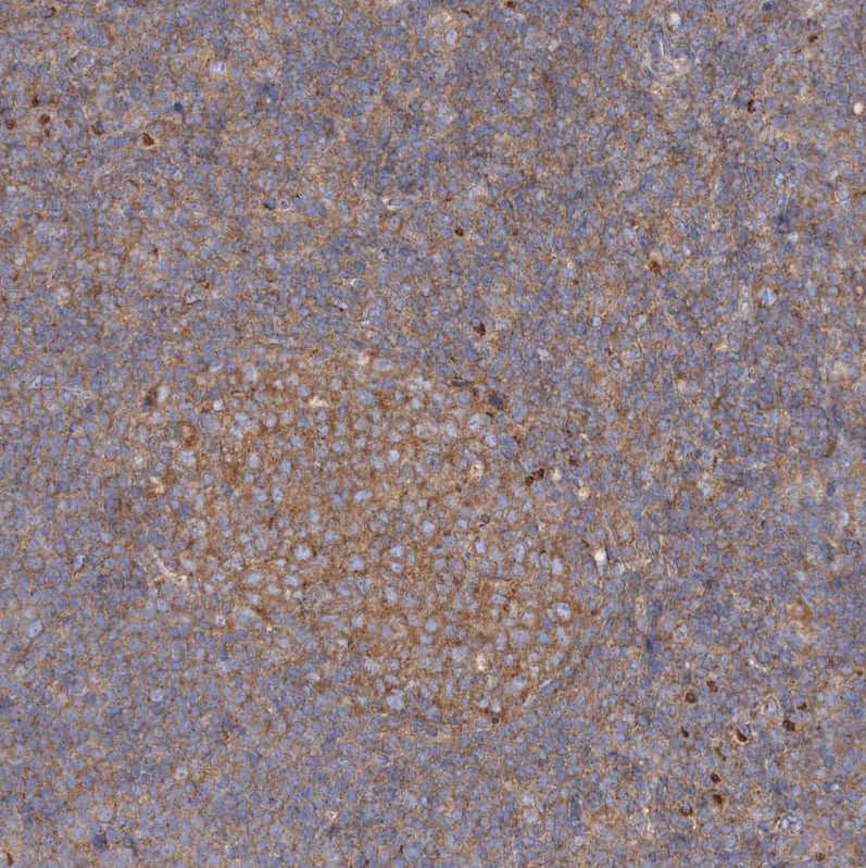 Staining of human tonsil shows moderate granular cytoplasmic positivity in germinal center cells.
