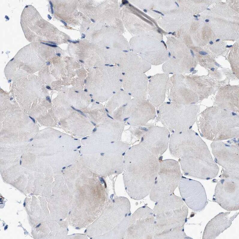 Staining of human skeletal muscle shows no positivity in myocytes as expected.