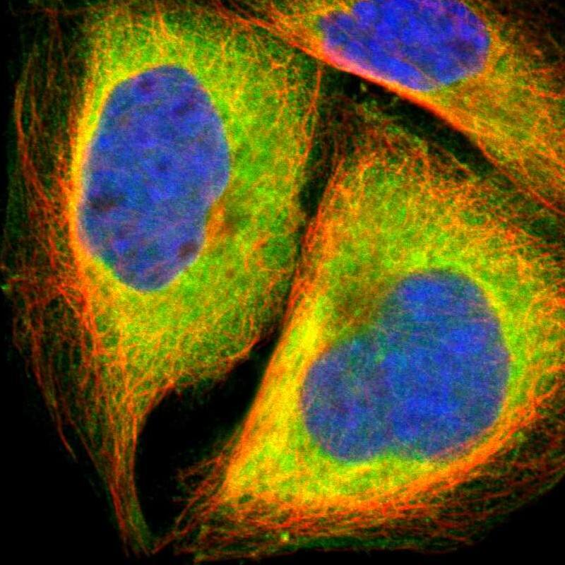 Immunocytochemistry/ Immunofluorescence SND1 Antibody