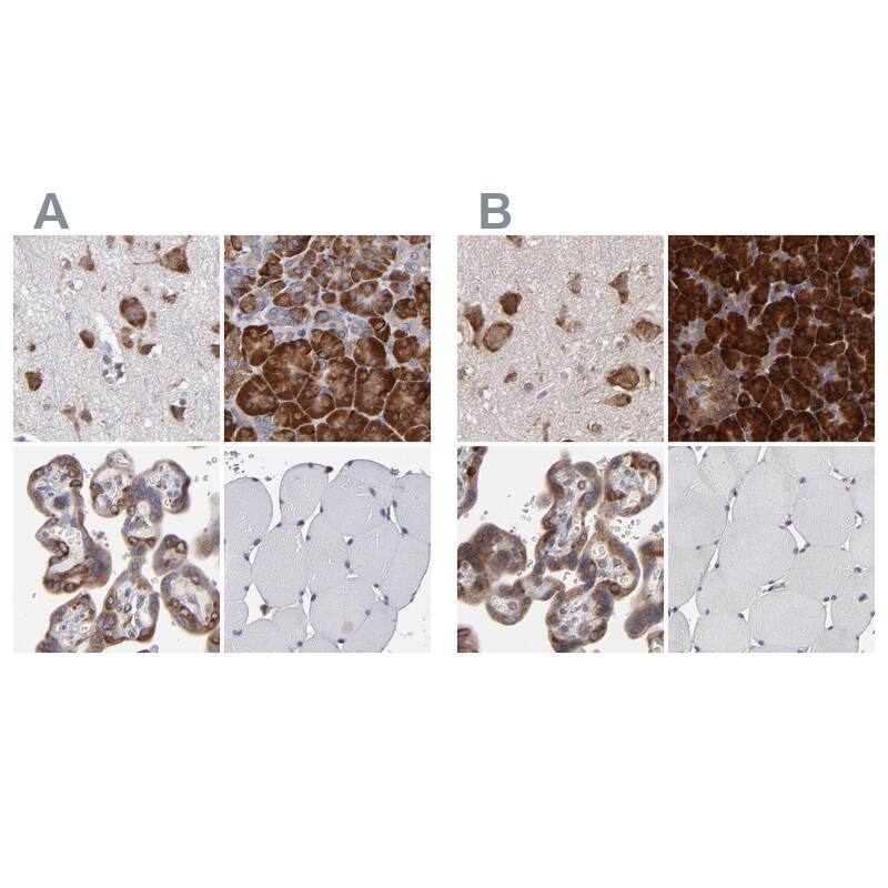 <b>Independent Antibodies Validation. </b>Staining of human cerebral cortex, pancreas, placenta and skeletal muscle using NBP1-82460 (A) shows similar protein distribution across tissues to independent antibody NBP1-82461 (B).