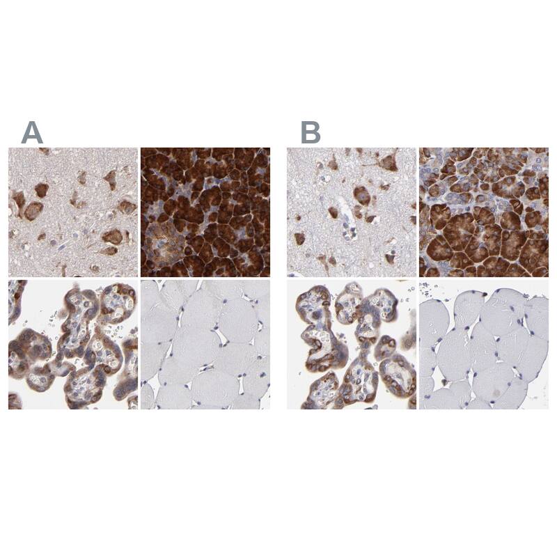 <b>Independent Antibodies Validation. </b>Staining of human cerebral cortex, pancreas, placenta and skeletal muscle using NBP1-82461 (A) shows similar protein distribution across tissues to independent antibody NBP1-82460 (B).