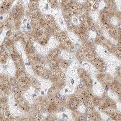 Staining of human liver.