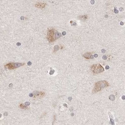 Staining of human cerebral cortex.