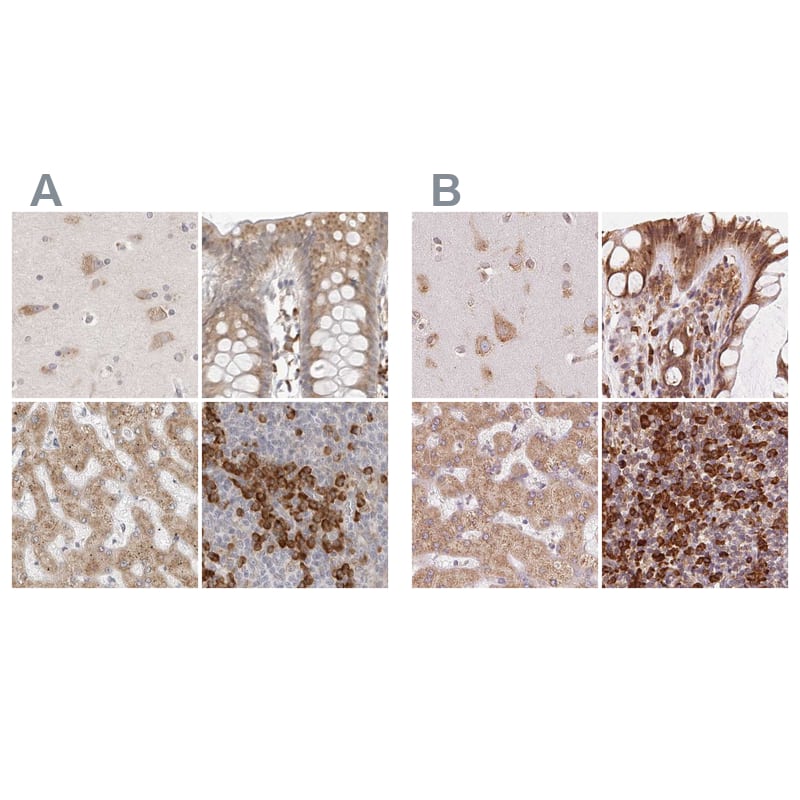 <b>Orthogonal Strategies Validation. </b>Staining of human cerebral cortex, colon, liver and tonsil HPA026828 (A) shows similar protein distribution across tissues to independent antibody HPA051520 (B).