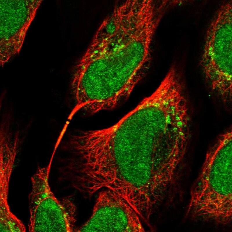 Staining of human cell line U-2 OS shows localization to nucleoplasm, the Golgi apparatus & vesicles.