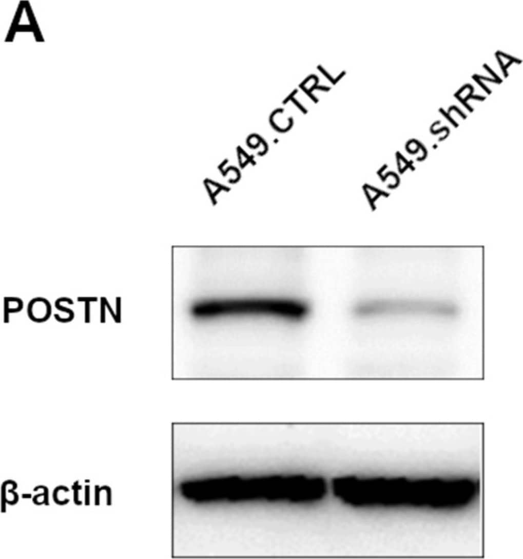 Western Blot: Periostin/OSF-2 Antibody [NBP1-82472] - The efficacy of shRNA lentiviral particles transfection. (A) Silencing of periostin (POSTN) expression was confirmed by Western blot analysis.  beta -actin was used as an internal control. (B) Confocal images & fluorescence analysis showing the expression of POSTN in control A549.CTRL cells & A549.shRNA cells (*** p < 0.001). Objective 60×/1.40 Oil; pinhole airy 1.25. Bar = 20 µm. (C) The expression of POSTN mRNA in control cells (A549.CTRL) & the cells representing the loss-of-function phenotype (A549.shRNA). Relative expression (RQ) of the POSTN gene was normalized against the expression of ACTB (*** p < 0.001). RQ, relative quantification. Image collected & cropped by CiteAb from the following publication (//pubmed.ncbi.nlm.nih.gov/35163164), licensed under a CC-BY license. Not internally tested by Novus Biologicals.