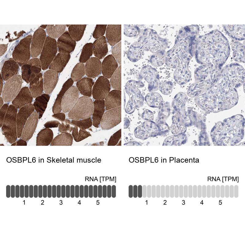 Immunohistochemistry-Paraffin OSBPL6 Antibody - BSA Free