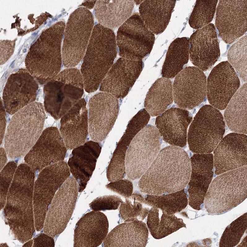 Immunohistochemistry-Paraffin OSBPL6 Antibody - BSA Free