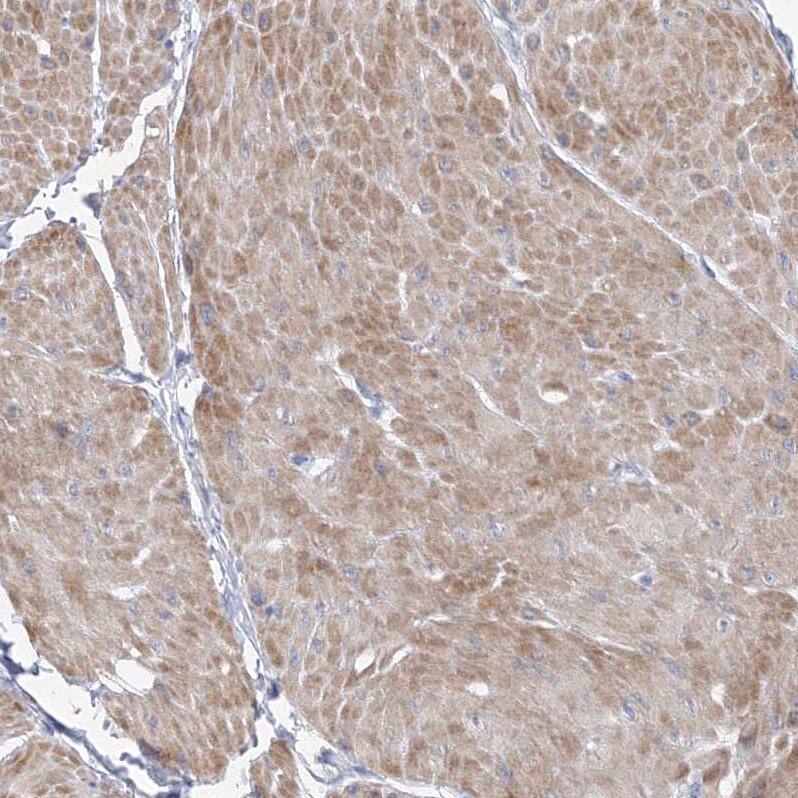 Immunohistochemistry-Paraffin OSBPL6 Antibody - BSA Free