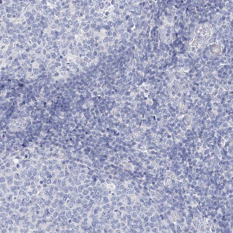 Immunohistochemistry-Paraffin OSBPL6 Antibody - BSA Free