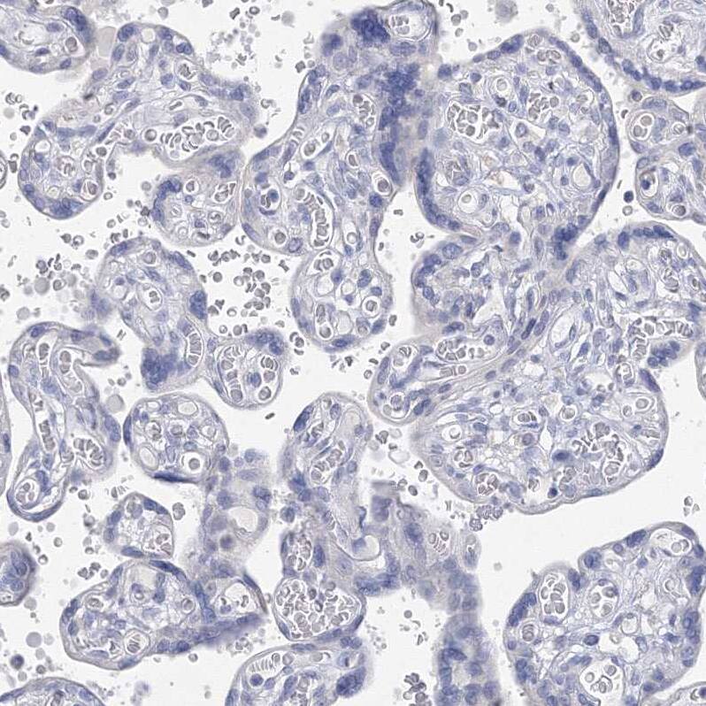 Immunohistochemistry-Paraffin OSBPL6 Antibody - BSA Free