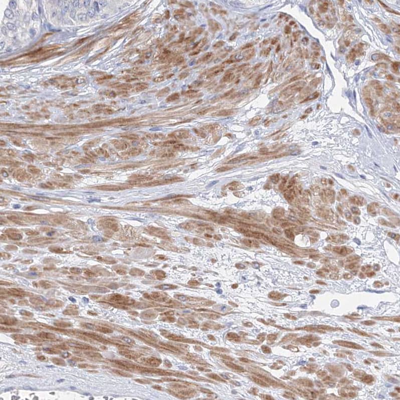 Immunohistochemistry-Paraffin OSBPL6 Antibody - BSA Free