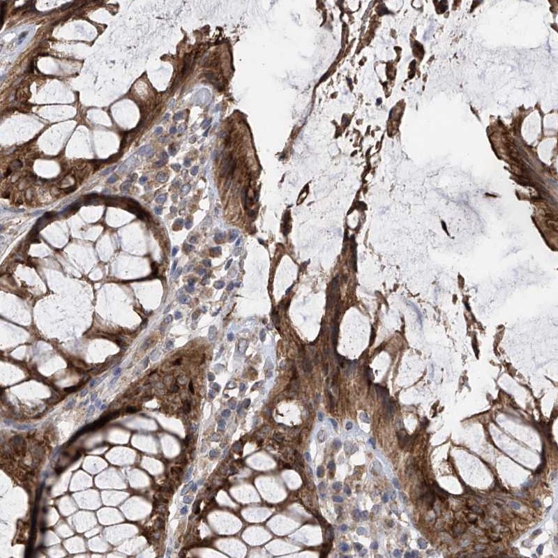 Immunohistochemistry-Paraffin PNPT1 Antibody - BSA Free