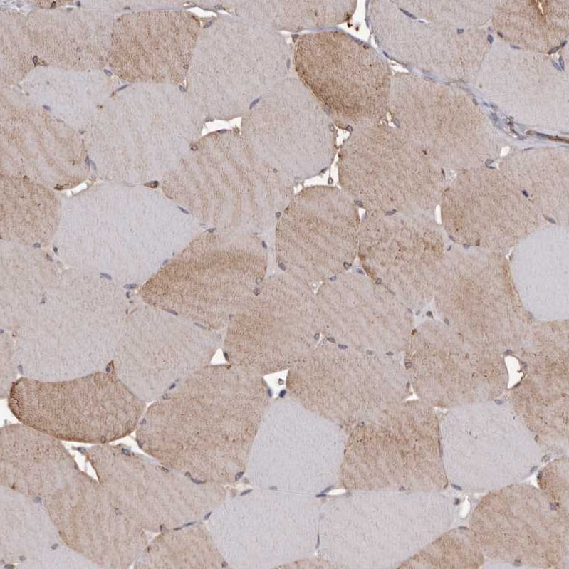 Staining of human skeletal muscle shows moderate cytoplasmic positivity in myocytes.