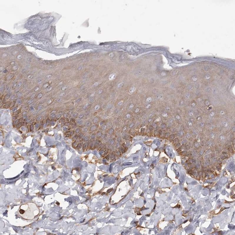 Staining of human skin shows strong cytoplasmic positivity in squamous epithelial cells.