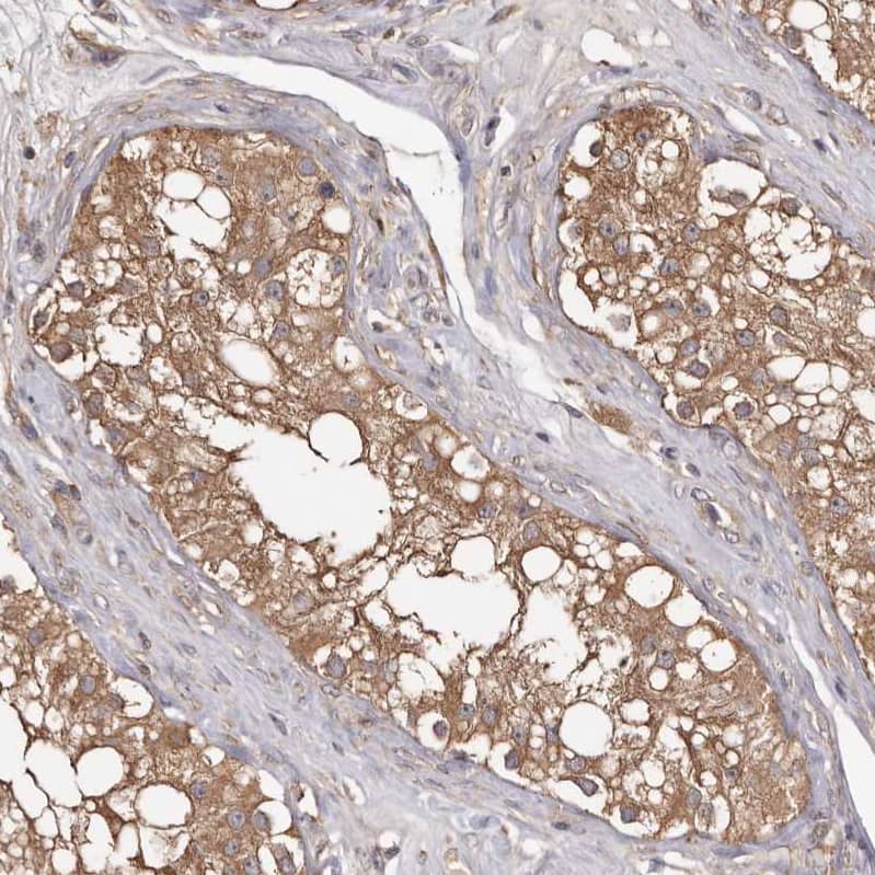 Staining of human testis shows strong cytoplasmic positivity in cells in seminiferous ducts.