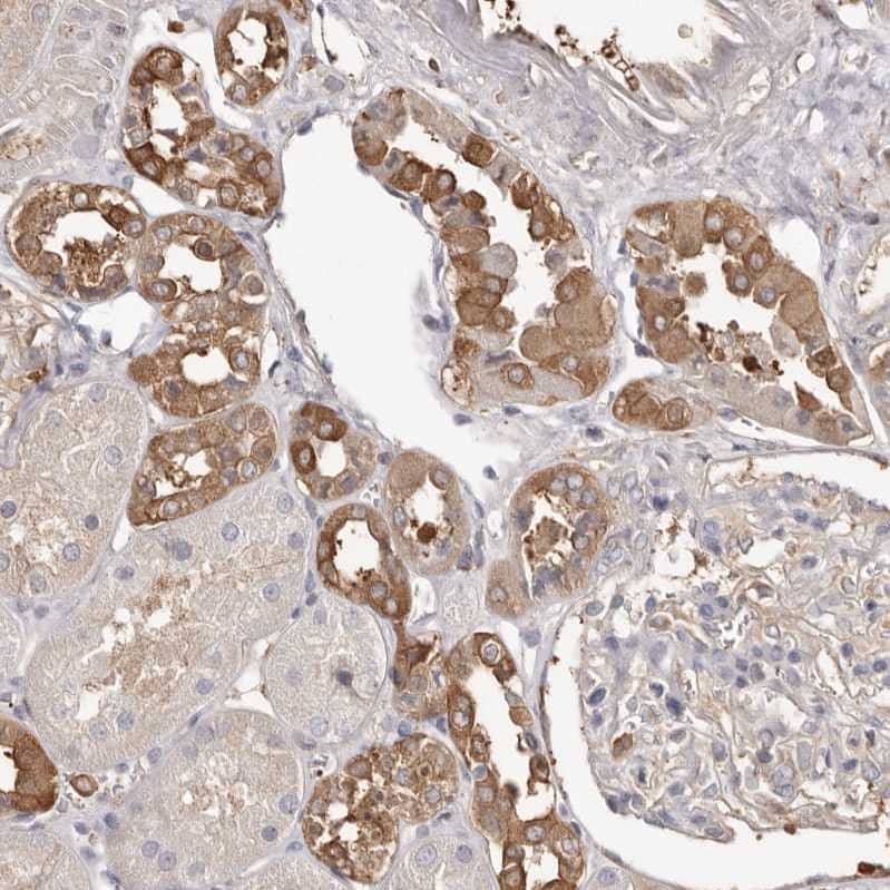 Staining of human kidney shows strong cytoplasmic positivity in cells in tubules.