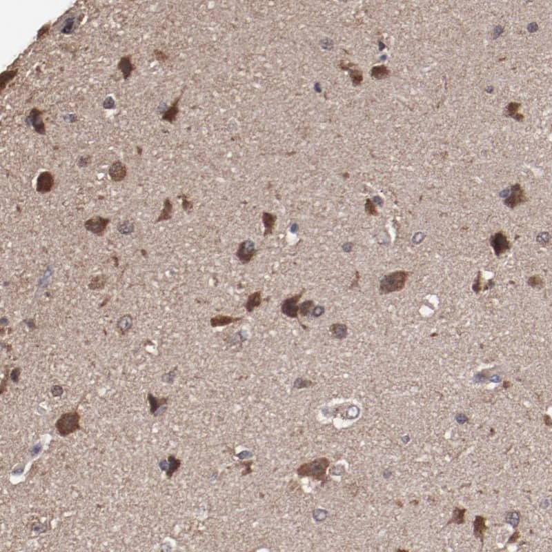 Staining of human cerebral cortex shows strong cytoplasmic positivity in neuronal cells.