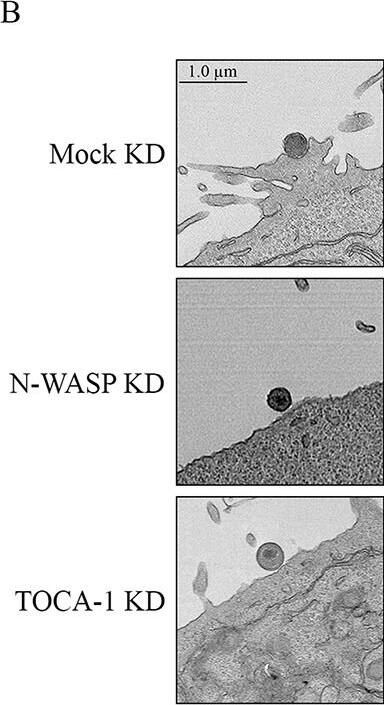 N-WASP and TOCA-1 play a role in C.t. pedestal-like structure formation. (A) N-WASP and TOCA-1 were knocked down in HeLa cells. Knockdown was verified using Western blotting, probing with anti-GAPDH, anti-N-WASP, and anti-TOCA-1 antibodies and quantified using densitometry, with relative density or adjusted relative density shown under the blots. Relative density was determined compared to mock KD, and relative density was adjusted for the N-WASP and TOCA-1 blots compared to the GAPDH standards. (B) HeLa cells were asynchronously infected with WTL2 at an MOI of 50 for 15 minutes and imaged with transmission electron microscopy; three representative images are shown. (C) Quantification of EBs associated with pedestal-like structures. A total of 100 EBs per experiment were assessed from two separate experiments, in which images were blinded and categorized as associated or not associated with pedestal-like structures. EBs associated with pedestal-like structures were compared to total EBs to determine the percentage associated with pedestal-like structures. Data represent the mean of two biological replicates. Error bars represent SD, *P < 0.05. Significance was determined using one-way ANOVA followed by Tukey’s multiple comparisons test. Image collected and cropped by CiteAb from the following open publication (//pubmed.ncbi.nlm.nih.gov/40231845), licensed under a CC-BY license. Not internally tested by Novus Biologicals.