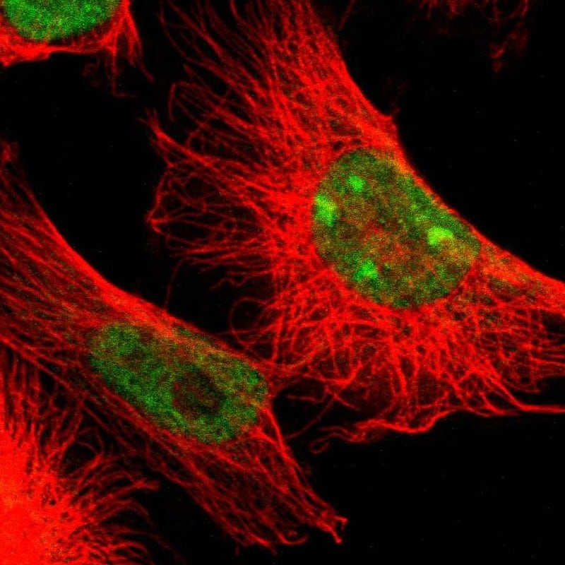 Staining of human cell line U-251 MG shows localization to nucleoplasm & nucleoli.