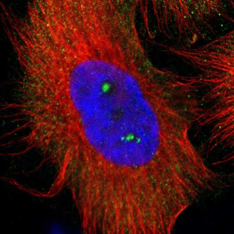 Staining of human cell line U-251 MG shows localization to nucleoli & cytosol.