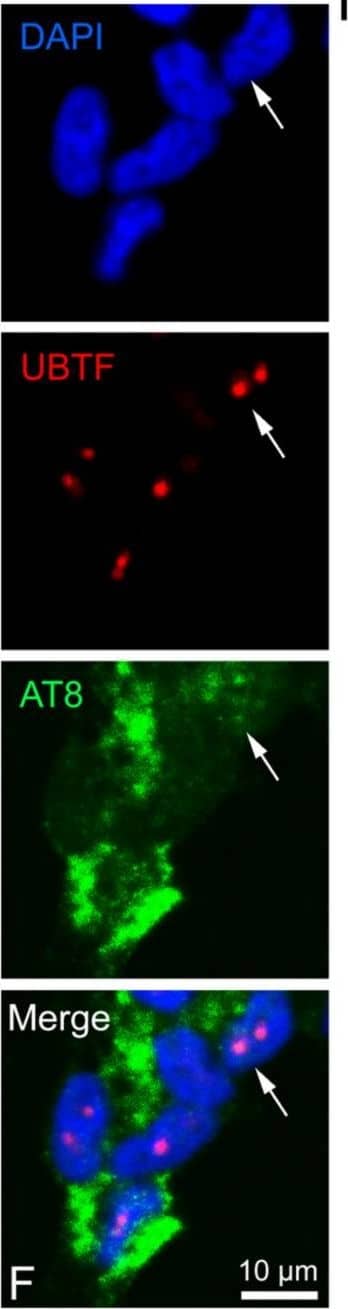 Dual color immunolocalization of tau epitopes in SH-SY5Y cells. (A–C) Replicative SH-SY5Y cells with the visualization of Tau-1, Tau-5, and AT8 epitopes, respectively. (D–F) Differentiated SH-SY5Y cells with the visualization of Tau-1, Tau-5, and AT8 epitopes, respectively. Tau-1, Tau-5, and AT8 were revealed by FITC-conjugated antibodies (green signals). Ki-67 (replication marker) and UBTF (nucleolar marker) were detected by TRITC-conjugated antibodies (red signals). DAPI (blue signals) was used to stain cell nuclei. White arrow in (E) indicates a cell nucleus with the presence of the Ki-67 marker. White arrow in (F) indicates the co-localization of AT8 and UBTF in a nucleus. Magnification is the same for all the images, with a unique scale bar shown in (F): 10 μm. The images were captured by confocal laser scanning microscope at 630× magnification. Software to analyze signal co-localization was ZEN-2010 (see Section 4). Image collected and cropped by CiteAb from the following open publication (//pubmed.ncbi.nlm.nih.gov/37762676), licensed under a CC-BY license. Not internally tested by Novus Biologicals.