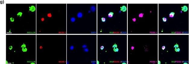 Immunocytochemistry/ Immunofluorescence NKX6.1 Antibody - BSA Free