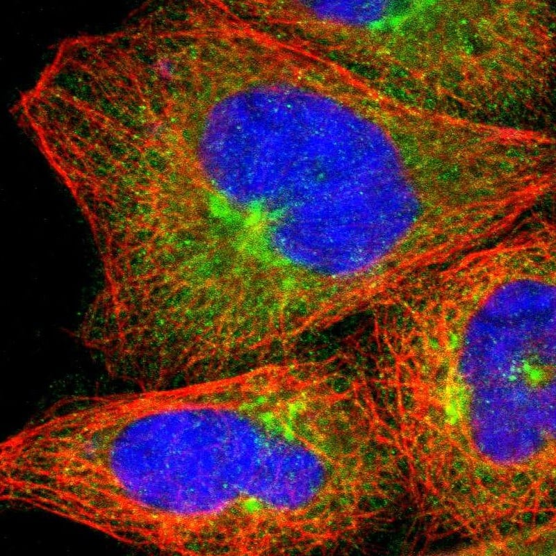 Staining of human cell line A-431 shows localization to cytosol & the Golgi apparatus.