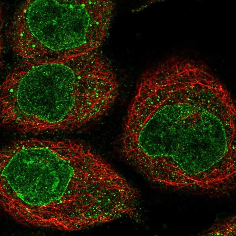 Staining of human cell line A-431 shows localization to nucleus & nuclear membrane.
