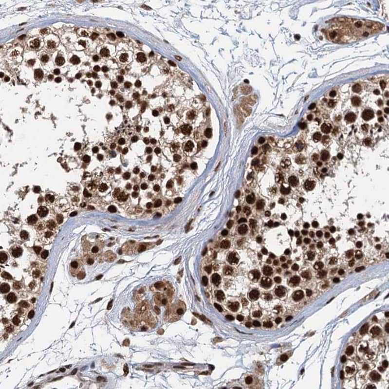 Immunohistochemistry-Paraffin NHN1 Antibody - BSA Free
