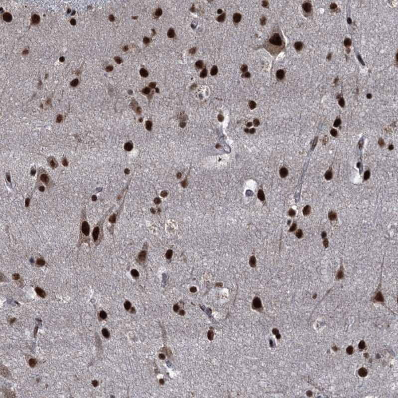 Immunohistochemistry-Paraffin NHN1 Antibody - BSA Free