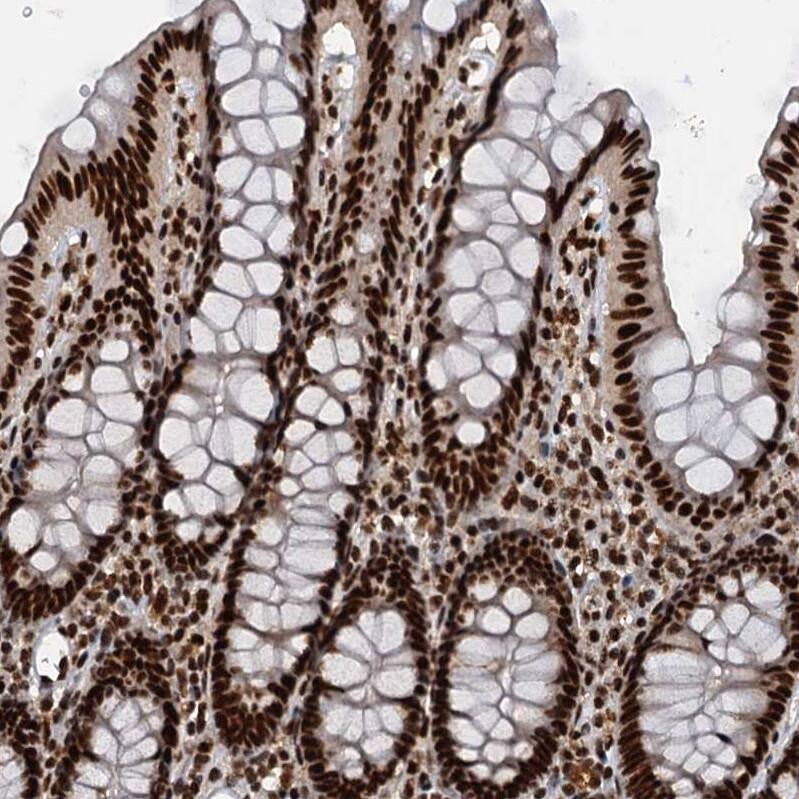 Immunohistochemistry-Paraffin NHN1 Antibody - BSA Free