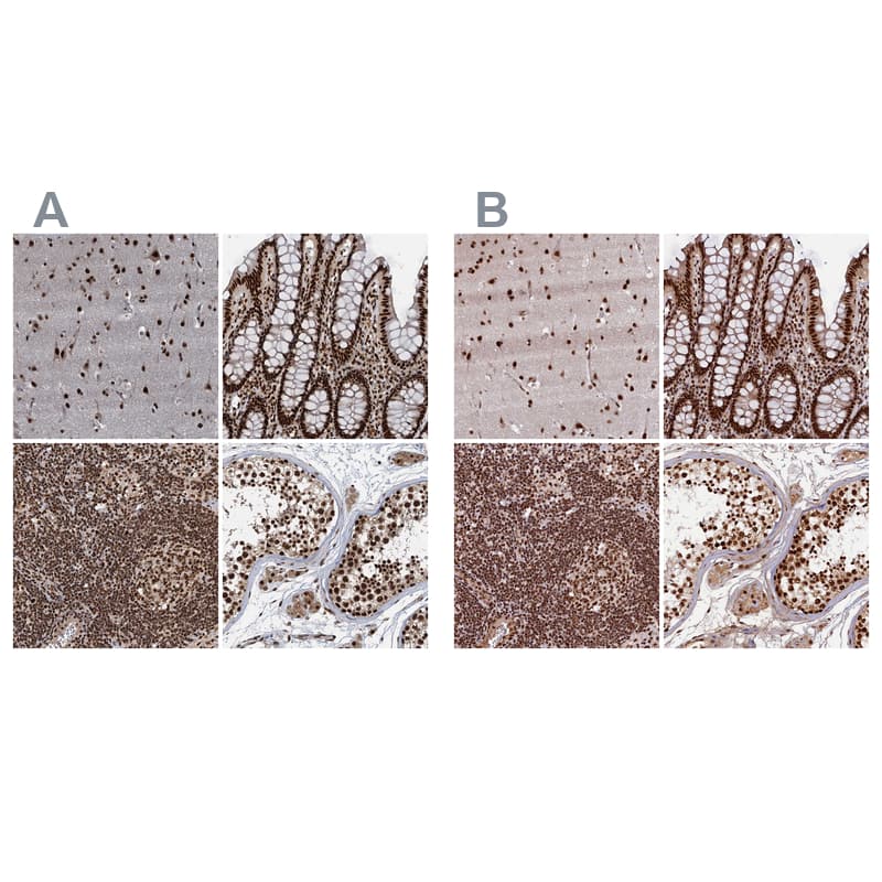 Immunohistochemistry-Paraffin NHN1 Antibody - BSA Free