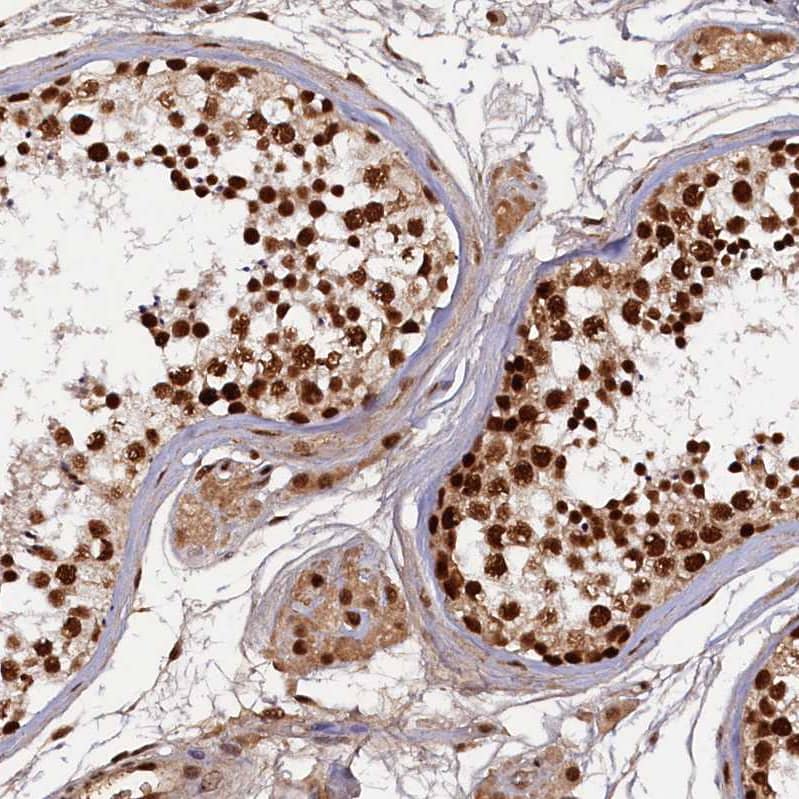 Immunohistochemistry-Paraffin NHN1 Antibody - BSA Free