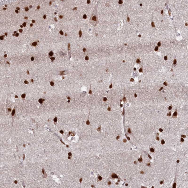 Immunohistochemistry-Paraffin NHN1 Antibody - BSA Free