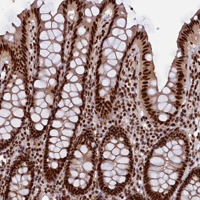 Immunohistochemistry-Paraffin NHN1 Antibody - BSA Free