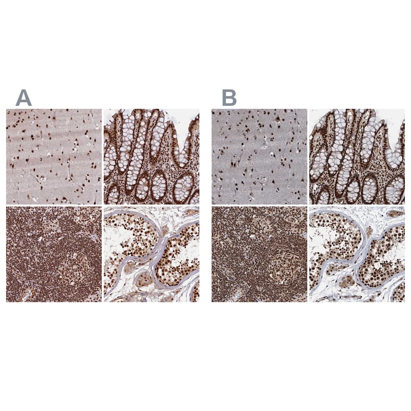 Immunohistochemistry-Paraffin NHN1 Antibody - BSA Free