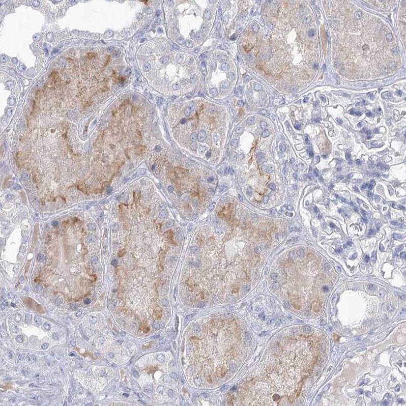 Staining of human kidney shows weak positivity in apical membrane in cells in tubules.