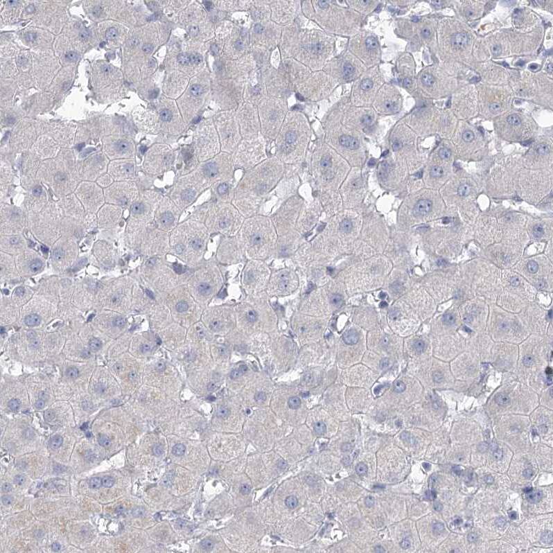 Staining of human liver shows no membranous positivity in hepatocytes as expected.