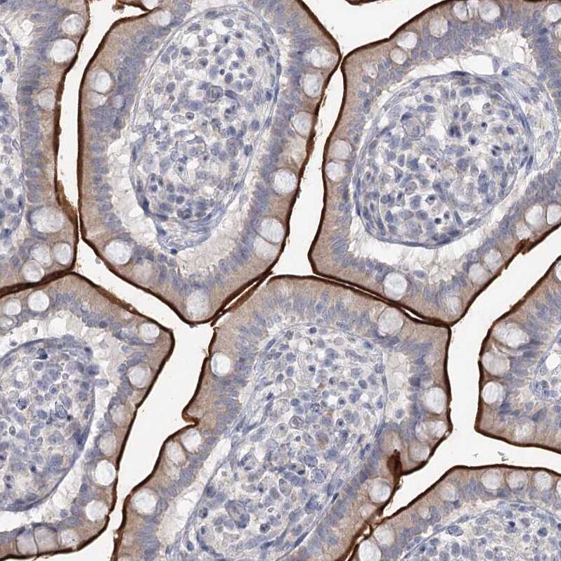 Staining of human small intestine shows strong positivity in apical membrane in glandular cells.