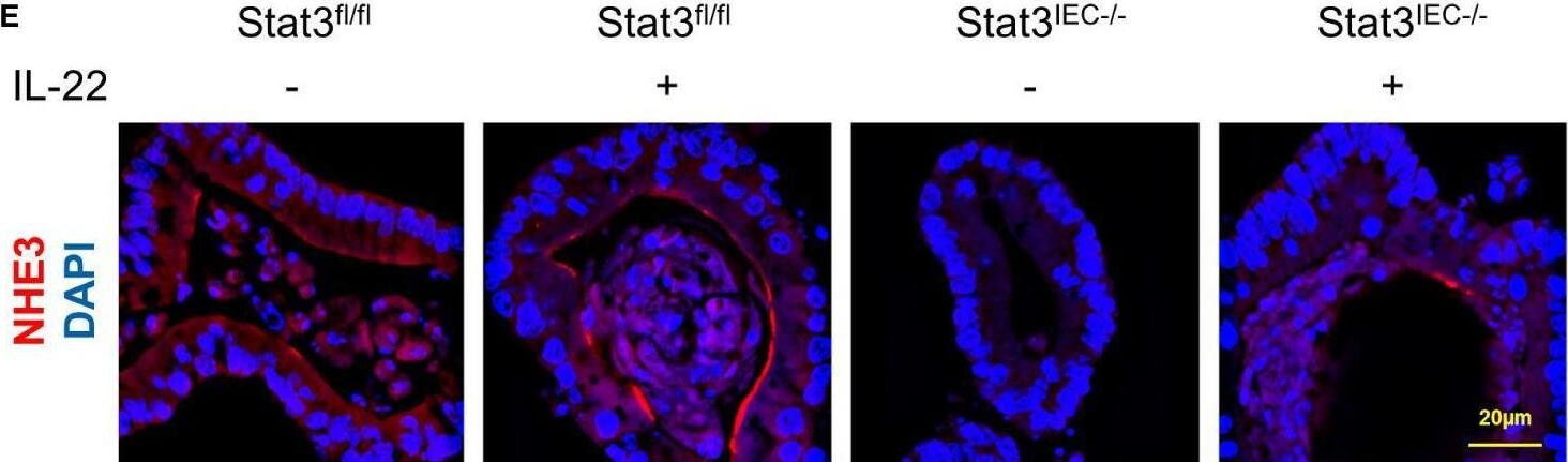 IL-22 stimulates IEC differentiation in a STAT3-depedent manner in mice and cultured organoids. WT mice were subjected to an 8-wk alcohol feeding, and IL-22 was i.p. injected at 1 mg/kg for the last 2 wk of feeding. (A) IF staining of ileal Ki67 (red) and nuclei (blue). Scale bar, 50 μm. (B) IF staining of ileal NHE3 (red) and nuclei (blue). Scale bar, 50 μm. (C) Organoid forming efficiency assessed by bright field imaging. Scale bar, 100 μm. Small intestinal organoids isolated from Stat3fl/fl and Stat3IEC-/- mice were treated with 100 ng/ml IL-22 for 10 h. (D) The mRNA levels of Nhe3 in organoids isolated from Stat3fl/fl and Stat3IEC-/- mice after IL-22 treatment. ***P < 0.001. (E) IF staining of NHE3 (red) in organoids after IL-22 treatment. Nuclei were stained by DAPI (blue). Scale bar, 20 μm. Image collected and cropped by CiteAb from the following open publication (//pubmed.ncbi.nlm.nih.gov/37908362), licensed under a CC-BY license. Not internally tested by Novus Biologicals.