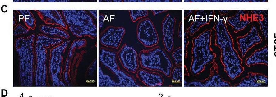IFN-gamma  treatment activates intestinal STATs, improves gut barrier, and reversed alcohol-reduced antimicrobial peptide (AMP) levels. (A) WB and quantification of ileal STAT1 and STAT3. (B) IF staining of ileal ZO-1 (red) and nuclei (blue). Scale bar, 20 μm. Corrected total cell fluorescence (CTCF) of ZO-1 was quantified. (C) IF staining and quantification of ileal sodium-hydrogen exchanger 3 (NHE3; red). Nuclei were counterstained by DAPI (blue). Scale bar, 20 μm. (D) mRNA levels of ileal AMPs (n = 6 per group). *p < 0.05, **p < 0.01, and ***p < 0.001. PF, pair-fed; AF, alcohol-fed. Image collected and cropped by CiteAb from the following open publication (//pubmed.ncbi.nlm.nih.gov/33536944), licensed under a CC-BY license. Not internally tested by Novus Biologicals.
