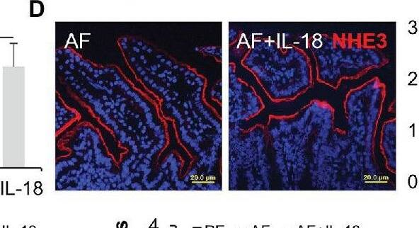 IL-18 treatment restitutes intestinal IFN-gamma  levels and ameliorates alcohol-induced gut-liver damage in mice. (A) Ileal IL-18 levels measured by ELISA. (B) Ileal IFN-gamma  levels. (C) IF staining and quantification of ileal ZO-1 (red). Nuclei were counterstained by DAPI (blue). Scale bar, 20 μm. (D) IF staining and quantification of ileal NHE3 (red). Nuclei were counterstained by DAPI (blue). Scale bar, 20 μm. (E) mRNA levels of ileal AMPs. (F) Plasma endotoxin levels. (G) H&E staining of mouse liver sections. Arrowheads indicate lipid accumulation and arrows indicate inflammatory cells. Scale bar, 20 μm. (H) Representative IHC staining of neutrophil marker, MPO, in the liver of mice. Arrows indicate positive staining. Scale bar, 20 μm. (I) mRNA levels of hepatic inflammatory chemokines, Cxcl1 and Mcp1 (n = 6 per group). *p < 0.05 and **p < 0.01. PF, pair-fed; AF, alcohol-fed; CTCF, corrected total cell fluorescence. Image collected and cropped by CiteAb from the following open publication (//pubmed.ncbi.nlm.nih.gov/33536944), licensed under a CC-BY license. Not internally tested by Novus Biologicals.
