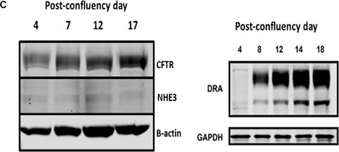 (A). Differentiation-dependent protein expression of NHE3, DRA, and CFTR in human enteroids. n = 3 (paired t-tests). Similar time-dependent mRNA (B) and protein (C) expression of NHE3, DRA, and CFTR in Caco-2-BBe monolayers with days post confluency. Image collected and cropped by CiteAb from the following open publication (//pubmed.ncbi.nlm.nih.gov/35928564), licensed under a CC-BY license. Not internally tested by Novus Biologicals.