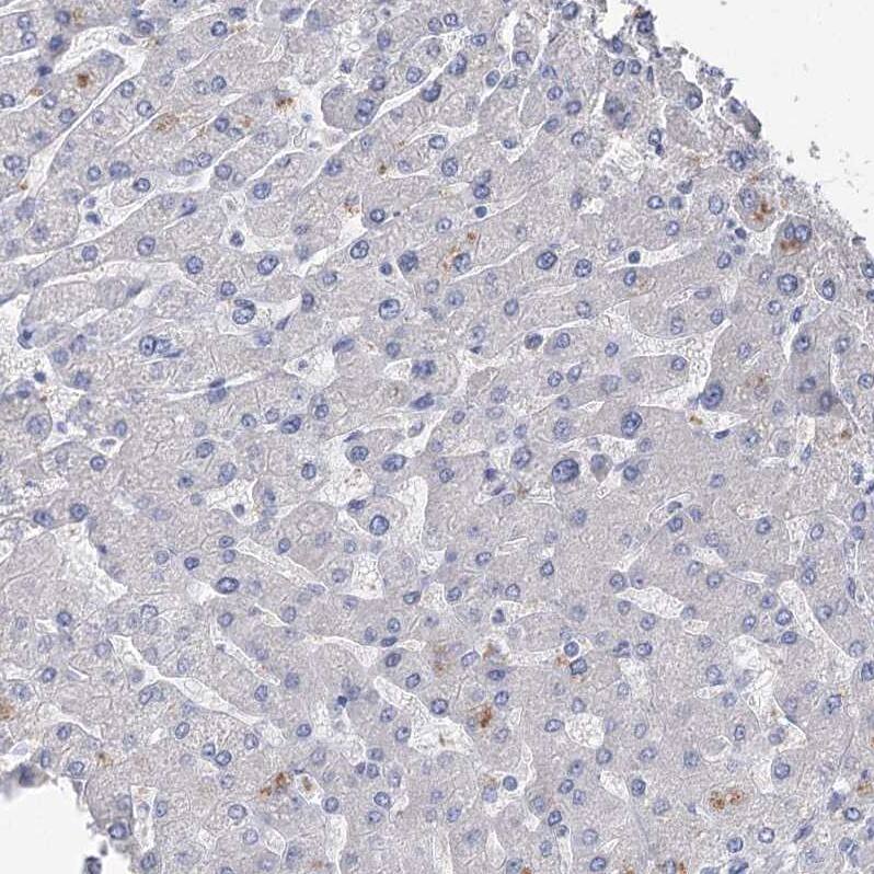 Staining of human liver shows no membranous positivity in hepatocytes as expected.
