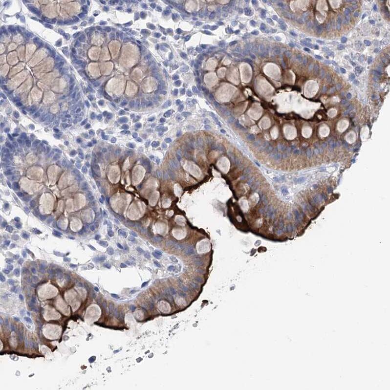 Staining of human colon shows strong positivity in apical membrane in glandular cells.