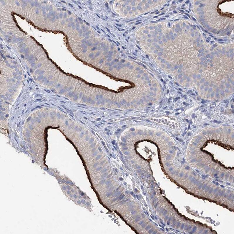 Staining of human gallbladder shows strong positivity in apical membrane in glandular cells.